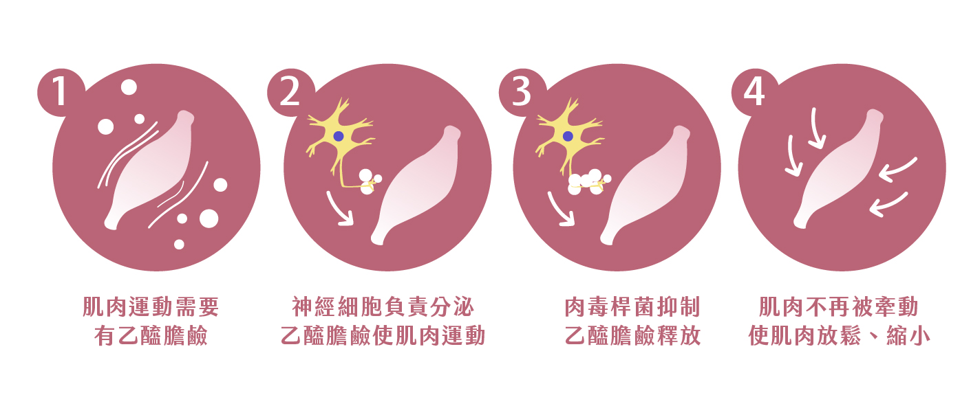 Botox美國保妥適肉毒 - 微風診所-台中醫美診所推薦 五星評論診所 4 Botox美國保妥適肉毒 - 微風診所-台中醫美診所推薦