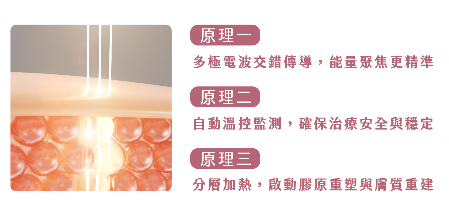 女王電波 - 微風診所-台中醫美診所推薦 五星評論診所 3 女王電波 - 微風診所-台中醫美診所推薦