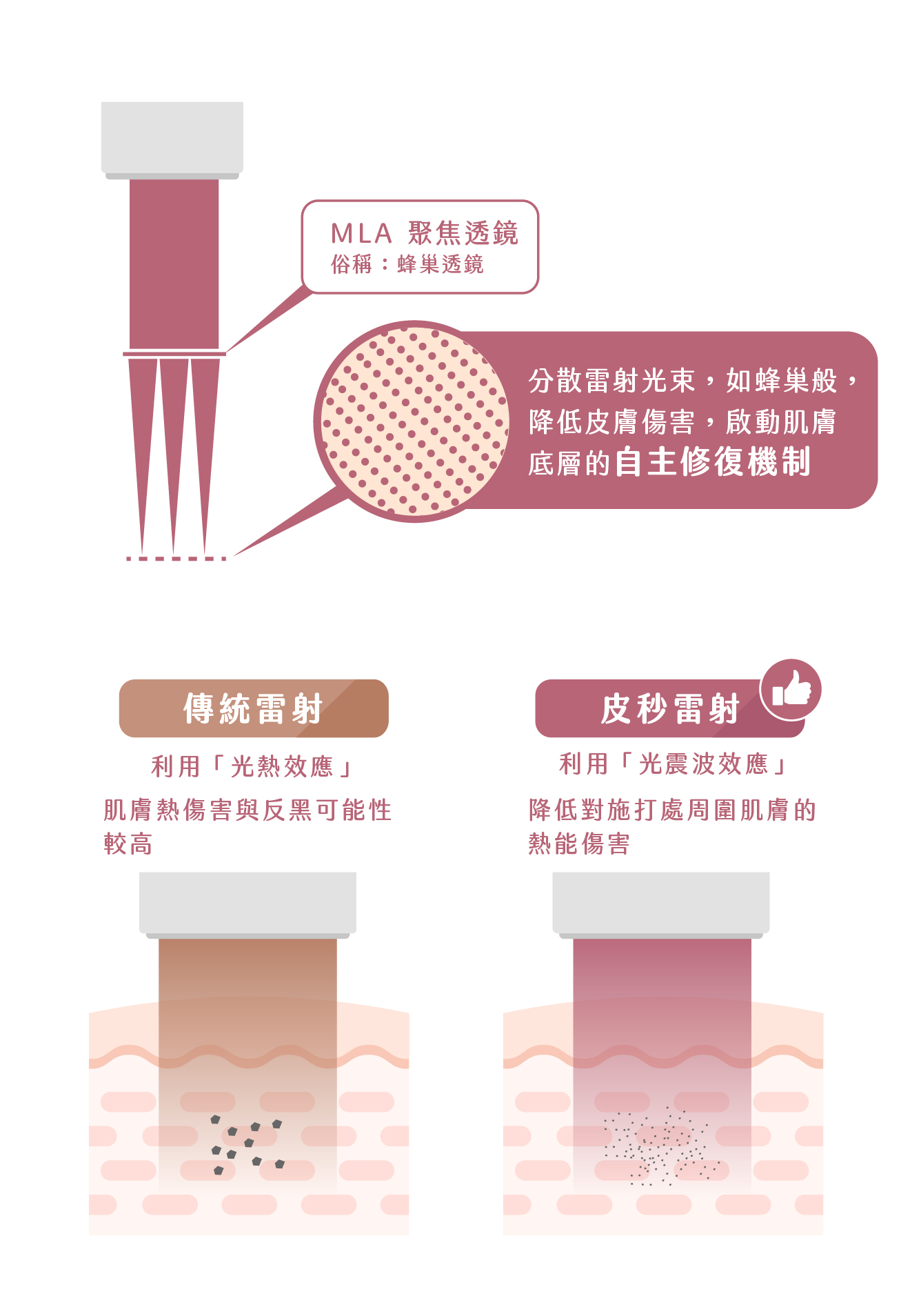 Discovery pico探索皮秒 - 微風診所-台中醫美診所推薦