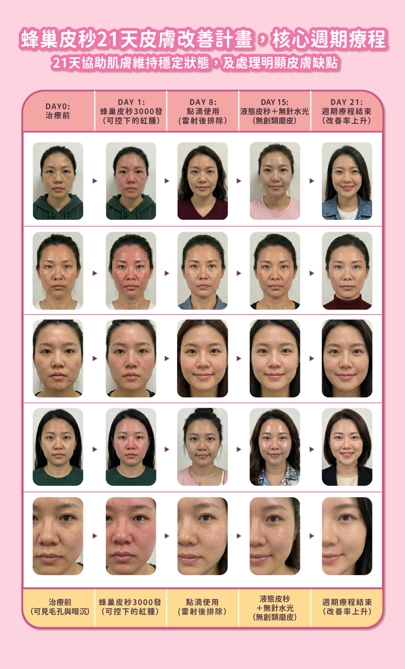 21天皮秒改善計畫 - 微風診所-台中醫美診所推薦